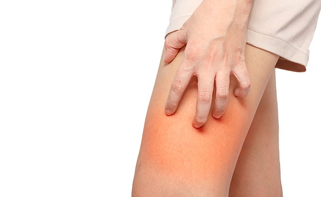 Skin chafing on thighs? Things to prevent and heal this painful